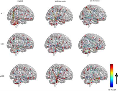 Classification of Cognitive Level of Patients with Leukoaraiosis on the Basis of Linear and Non-Linear Functional Connectivity